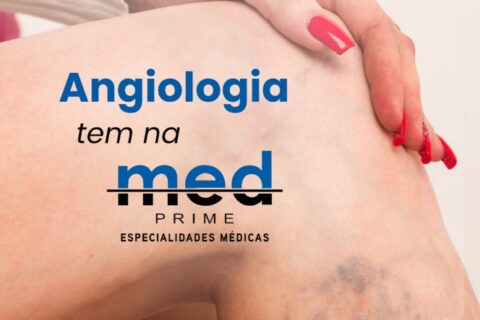 Angiologia: tem na Med Prime