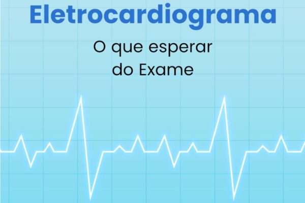 Eletrocardiograma: o que esperar do exame